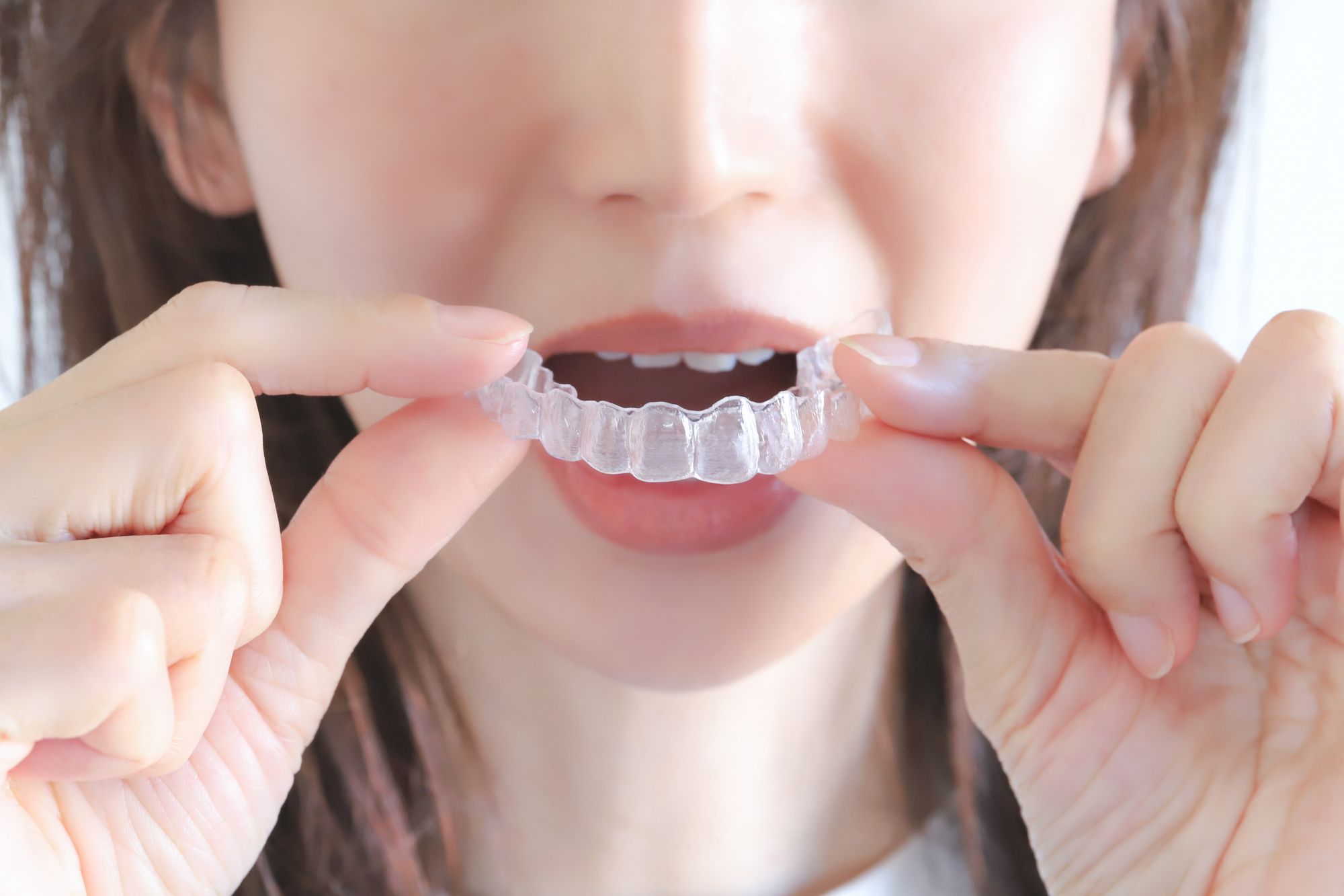 インビザライン